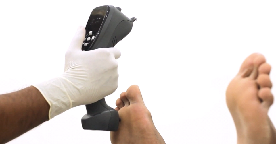 Early Detection, Better Outcomes: The Power of 5 Tests in Diabetic Foot Care