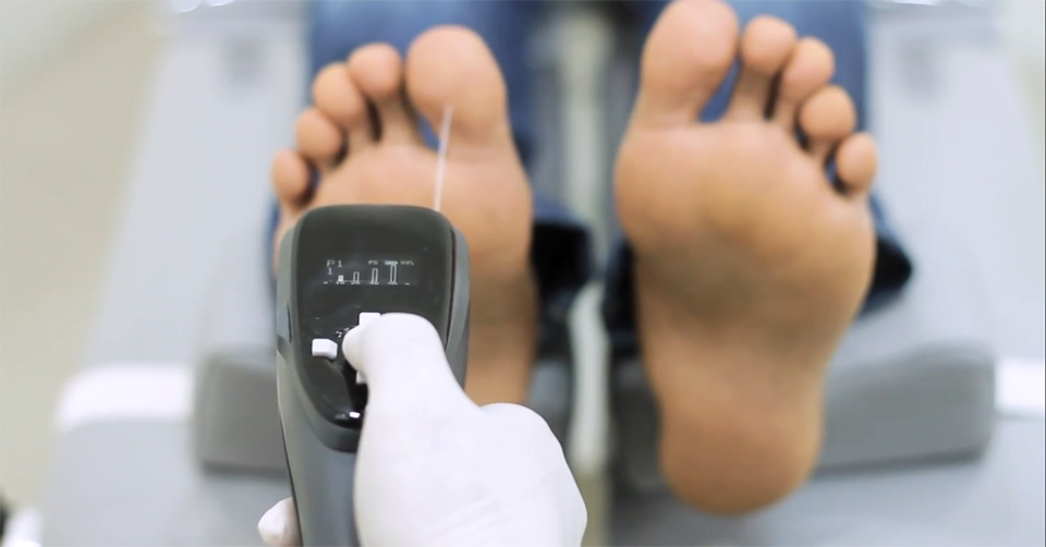 Integrated Diabetic Foot Assessment: Monofilament, Vibration, Temperature, and More